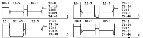 有載調(diào)壓分接開(kāi)關(guān)測(cè)試儀